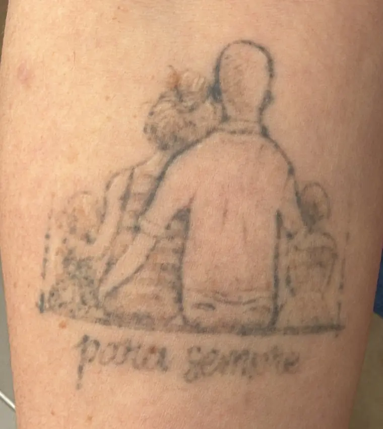 Depois: tatuagem de família clareada