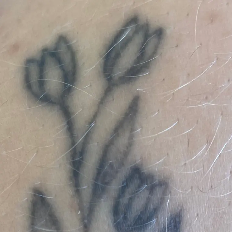 Antes: tatuagem de tulipas em traço fino
